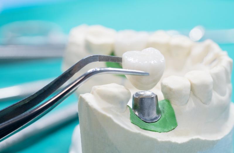 Clínica dental en Getxo